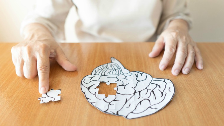 Деменция у пожилых людей влияние на головной мозг